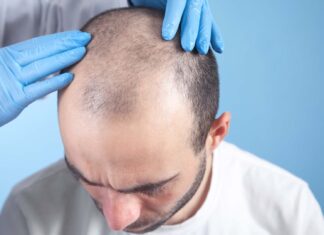 Best Hair Transplant in Chandigarh – Reestablish Certainty with Progressed Techniques Best Hair Transplant in Chandigarh